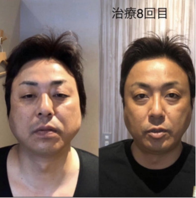 鍼処MUCALINDAのこだわりポイント