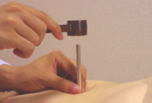 橋本鍼灸院のこだわりポイント