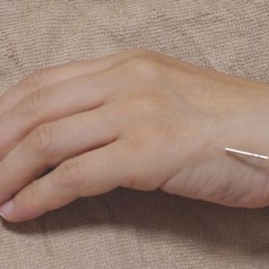 橋本鍼灸院のこだわりポイント