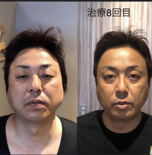 鍼処SHIRAKAWAなごや院中川 (ルート治療専門院)のこだわりポイント