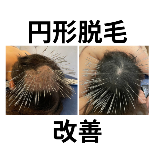 KUR鍼灸治療院〜ルート治療専門院〜のこだわりポイント