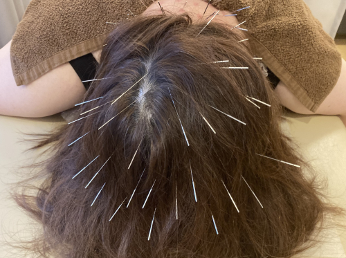 鍼灸指圧治療院 〜雅〜のこだわりポイント