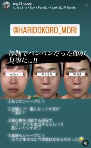 はり処もり　(ルート鍼専門院)のこだわりポイント
