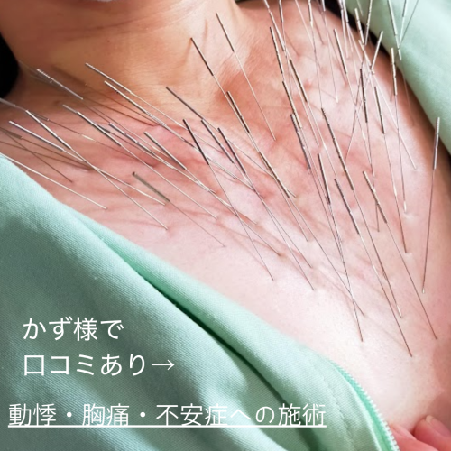 はり処もり　(ルート鍼専門院)のこだわりポイント