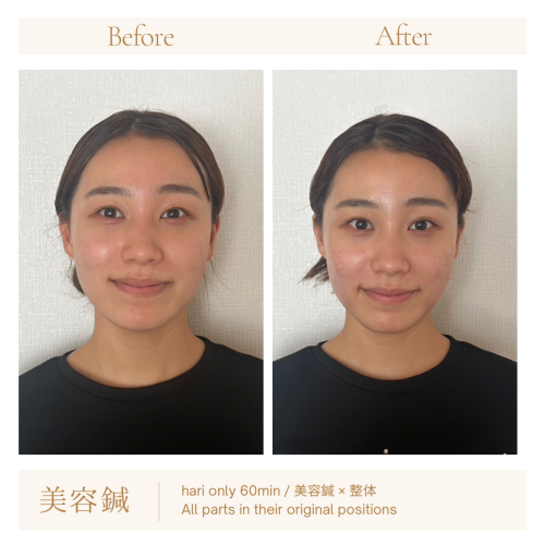 pariwar 美容鍼サロンのこだわりポイント