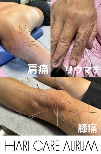 HARI CARE AURUM香川県丸亀市土器町のこだわりポイント