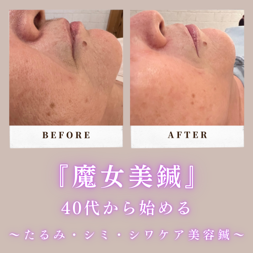 HARIS美容鍼灸整体院のこだわりポイント