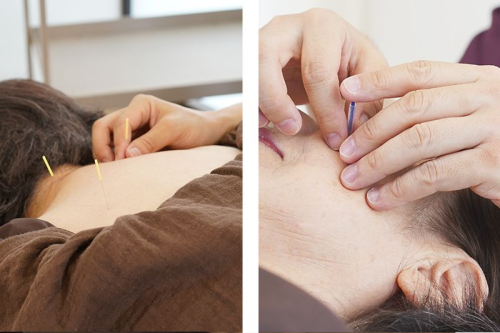 やわらか鍼灸院のこだわりポイント