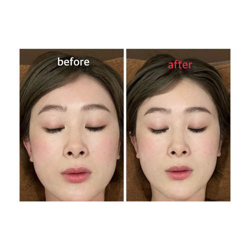 鍼灸マッサージYOKAanbeのこだわりポイント