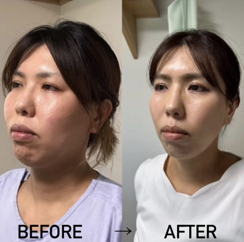 カラダトハナス鍼灸院のこだわりポイント