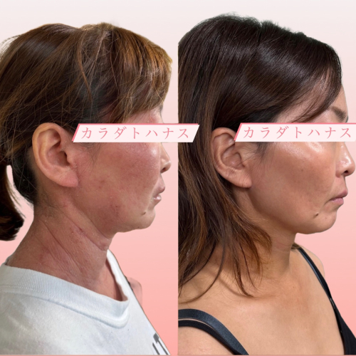 カラダトハナス鍼灸院のこだわりポイント