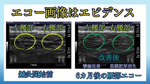 吉岡鍼灸整骨院のこだわりポイント