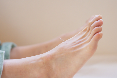 鍼灸　雪華のこだわりポイント