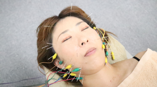 すこやか鍼灸整体院のこだわりポイント