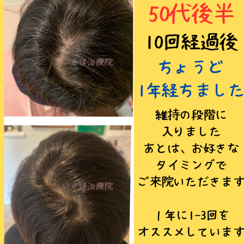 薄毛鍼 本気で向き合う いくほ治療院のこだわりポイント