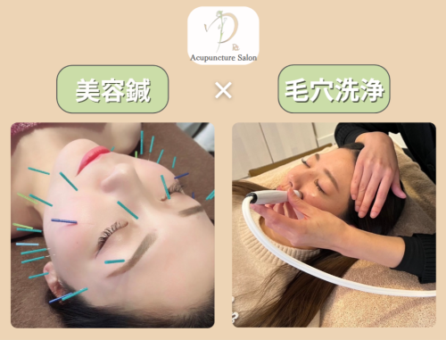 美容鍼×毛穴洗浄のお店 鍼灸サロンゆりのこだわりポイント