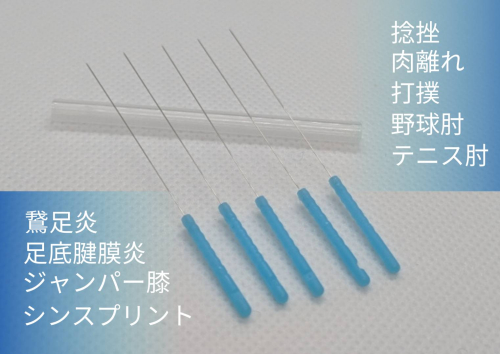 かつた鍼灸接骨院のこだわりポイント