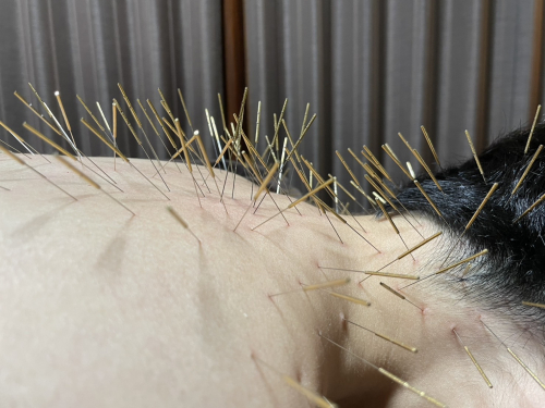はり処 松陽堂 谷町六丁目 ルート治療 生駒出張所のこだわりポイント