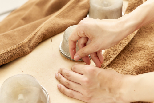 鍼灸サロンシエスタのこだわりポイント