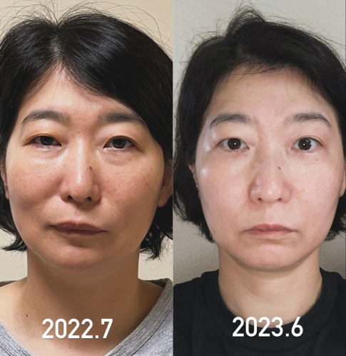 鍼処suzunone【女性専用ルート治療専門鍼灸院】のこだわりポイント