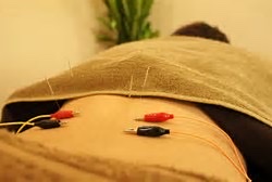 松山やわら鍼灸整骨院／整体院のこだわりポイント