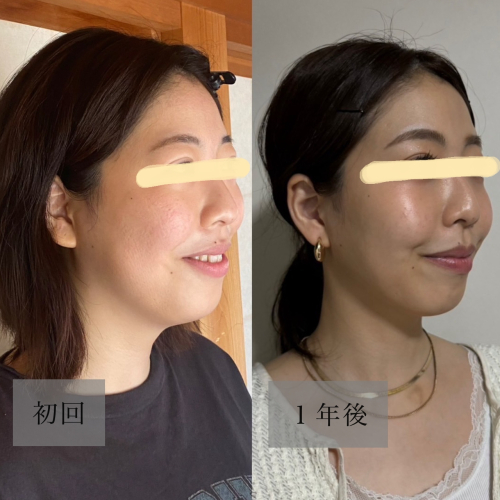 鍼処 u.【ルート治療専門】のこだわりポイント