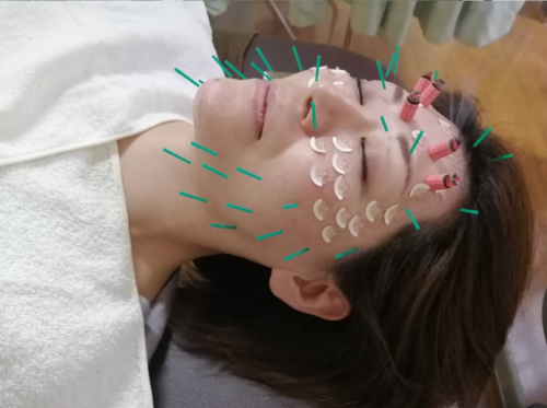 江戸橋からだメンテナンス鍼灸治療院のこだわりポイント