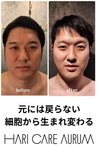 HARI CARE AURUM香川県丸亀市土器町のこだわりポイント