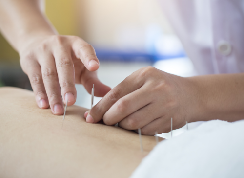 旭はりきゅうのこだわりポイント