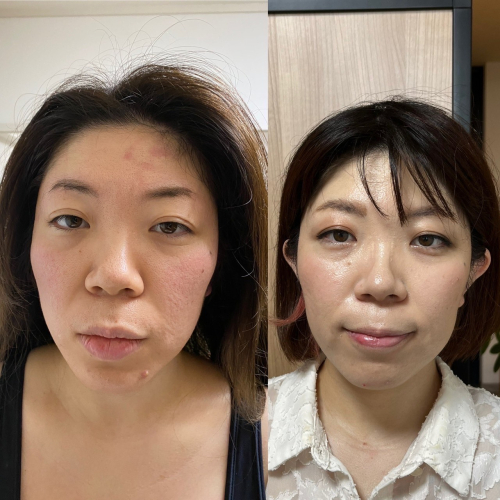 ルート鍼灸治療院ほむらのこだわりポイント