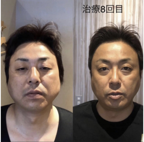 鍼処-美をつくしのこだわりポイント