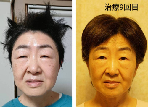 山本鍼灸院のこだわりポイント
