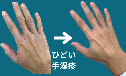 はり治療院ここから本庄院のこだわりポイント