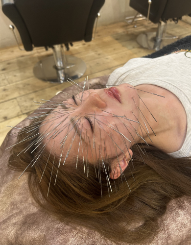 Remis鍼治療院　ルート治療専門のこだわりポイント