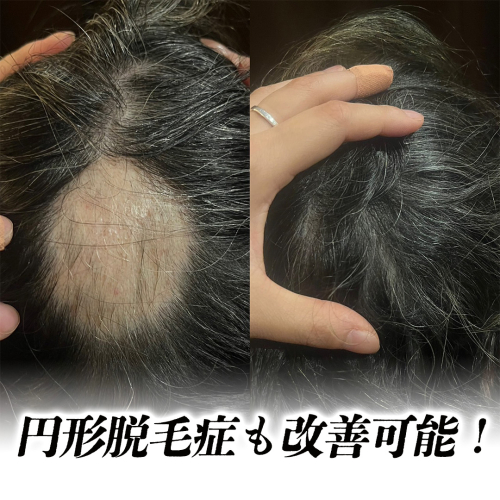 鍼処 紡ぐのこだわりポイント