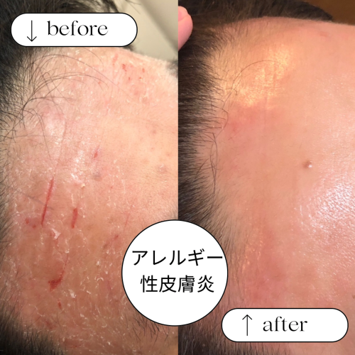 肌質改善サロン Natureのこだわりポイント