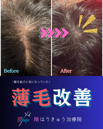 翔はりきゅう治療院のこだわりポイント