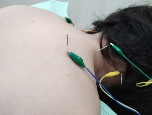 楽楽鍼灸院・整骨院のこだわりポイント