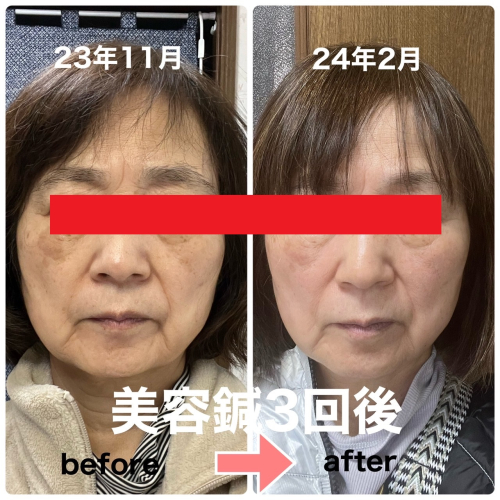 つつみ鍼灸整骨院のこだわりポイント