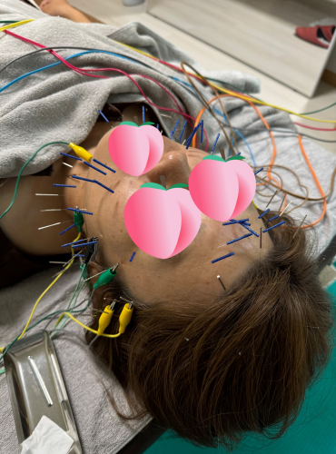 こうたろう鍼灸院のこだわりポイント