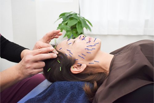 〜紡〜つむぎ鍼灸治療院・整体院のこだわりポイント