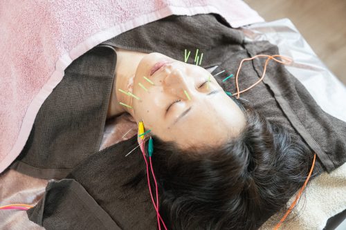 鍼灸院　はりのひとのこだわりポイント