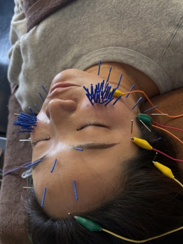 まつもと鍼灸院のこだわりポイント