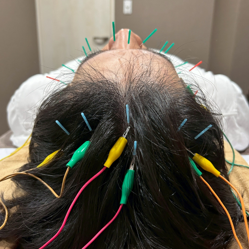 みやび鍼灸サロンのこだわりポイント