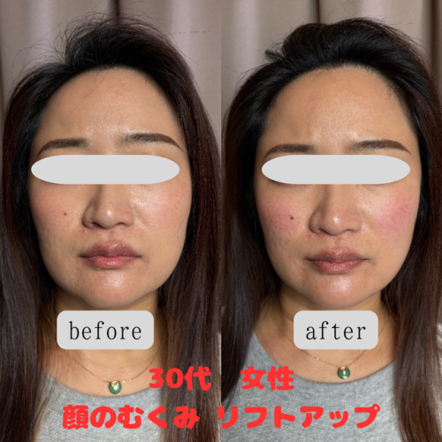 まつもと鍼灸院のこだわりポイント