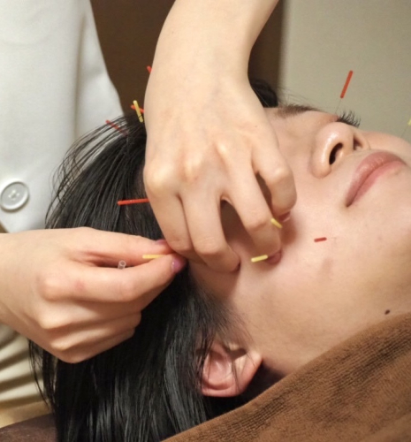 ひまわり鍼灸院【美容鍼】のこだわりポイント