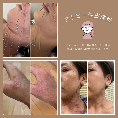 はりきゅう春信堂 目白院のこだわりポイント