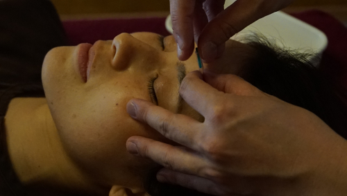 長山街道はりきゅう整骨院　我手田のこだわりポイント