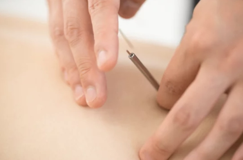 鍼灸院lokahiのこだわりポイント