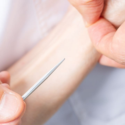 東洋鍼灸 楽のこだわりポイント